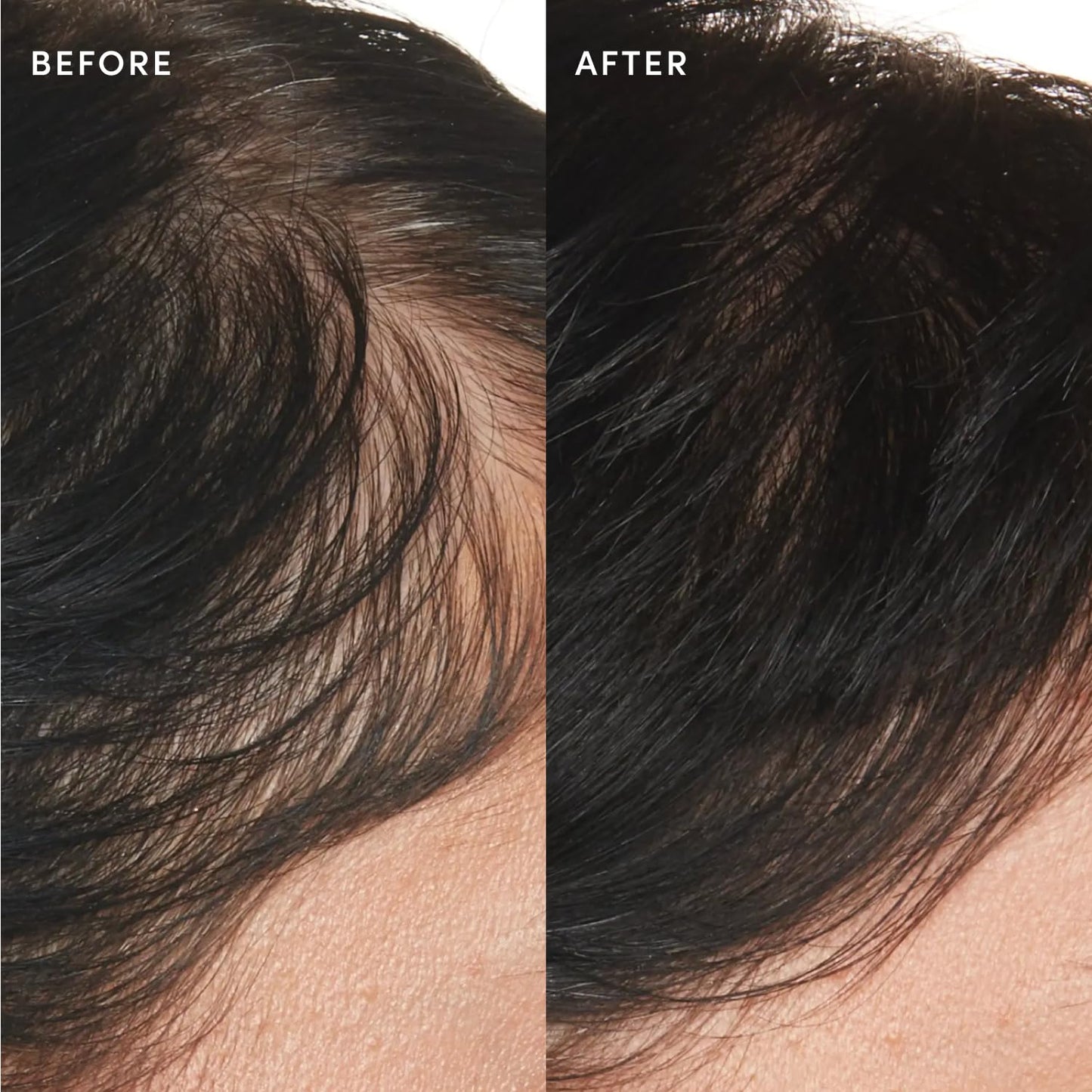 OUAI Scalp Serum for Thicker, Fuller-Looking Hair – 2 oz / 60 ml